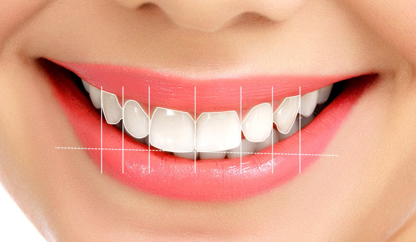 What Are Those Things In the Dentist’s Office