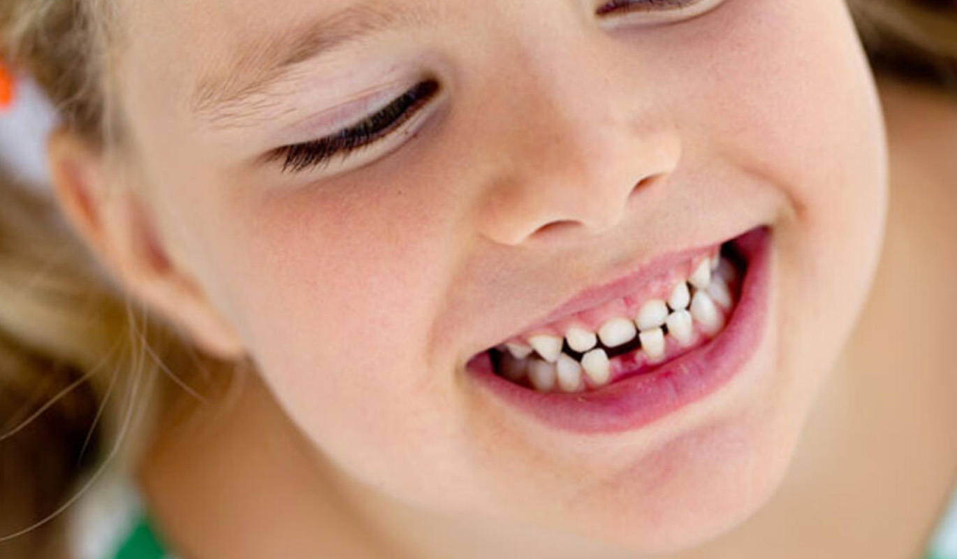 How Long Does It Take To Whiten Teeth